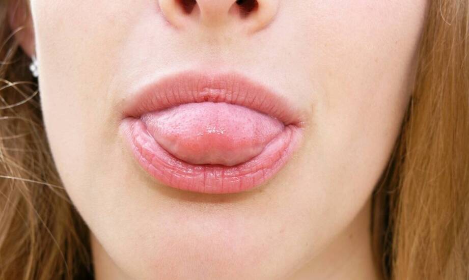 Modelowanie ust – jak przebiega zabieg i jakie daje efekty?