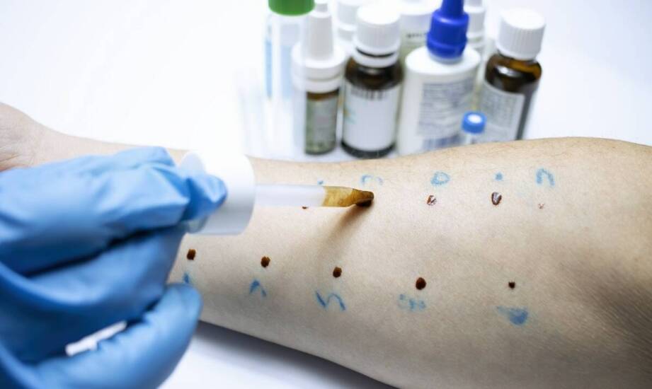 Jak rozpoznać warrozę i dlaczego zagraża zdrowiu rodzin pszczelich