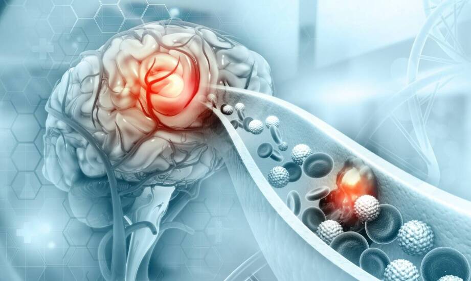 Nowoczesne metody leczenia nowotworów – jak przebiega terapia onkologiczna