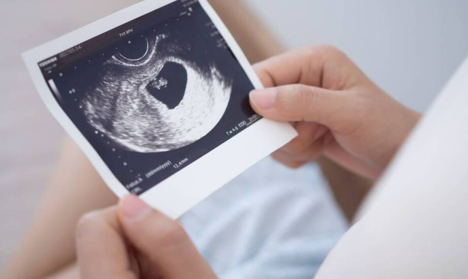 USG głowy u niemowląt – znaczenie badania i najważniejsze informacje