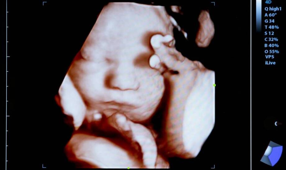 USG główki noworodka – przebieg badania i najważniejsze korzyści diagnostyczne