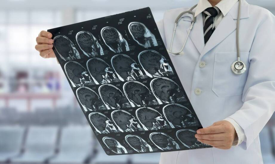 Czym zajmuje się neurolog i jakie objawy mogą wskazywać na choroby układu nerwowego