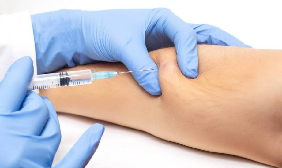 Terapia kolagenowa a mało inwazyjne leczenie stawów