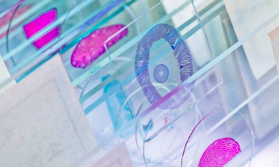 Siateczki do mikroskopii: kluczowy element w analizach mikrobiologicznych