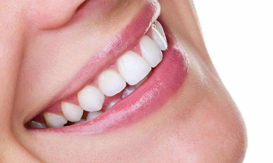 Bonding a naturalny wygląd zębów – jak uzyskać najlepsze efekty?