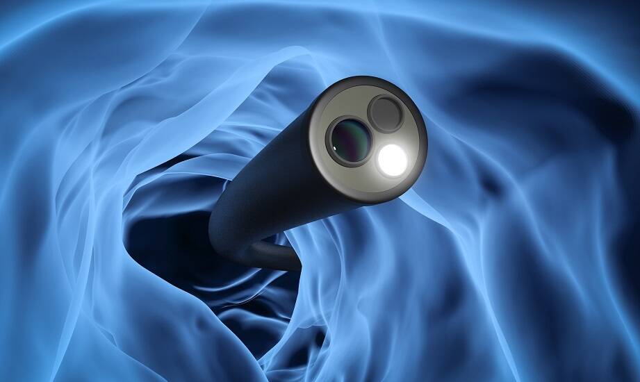 Jakie są wskazania do wykonania kolonoskopii przez proktologa?