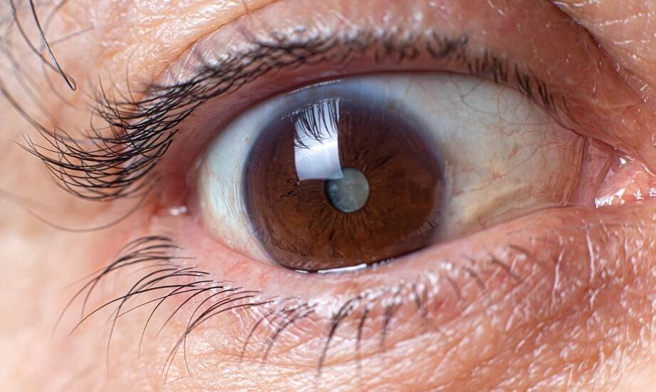 Porównanie różnych technik chirurgicznych stosowanych w usuwaniu zaćmy