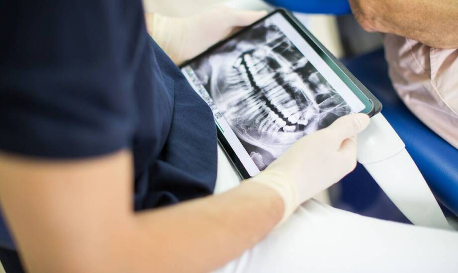 Jakie są korzyści z wykorzystania rentgena w leczeniu endodontycznym?