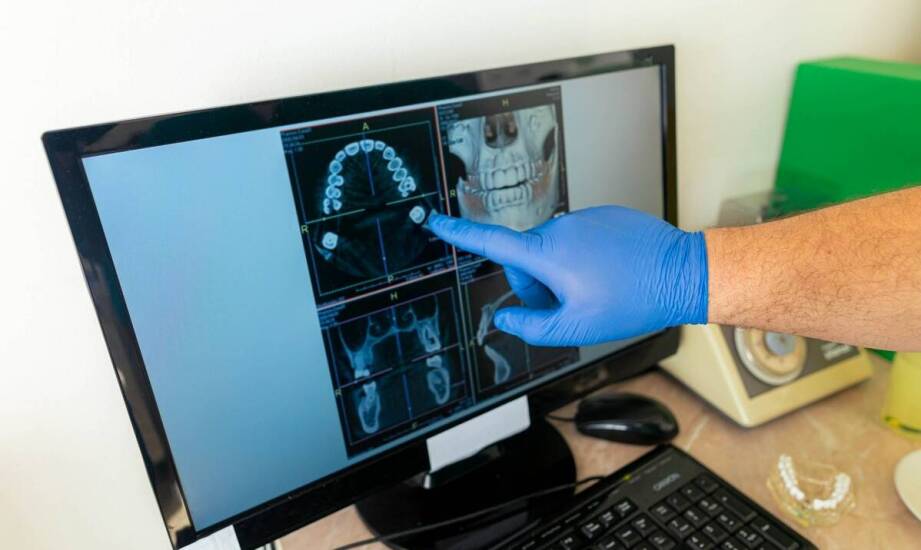 Rola rentgena w planowaniu zabiegów implantologicznych