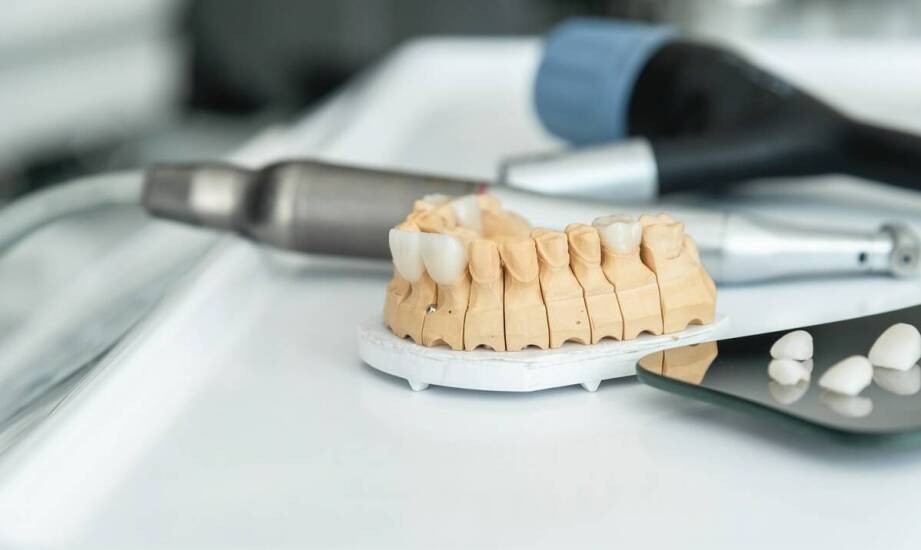 Czym różnią się implanty zębowe od mostów protetycznych?