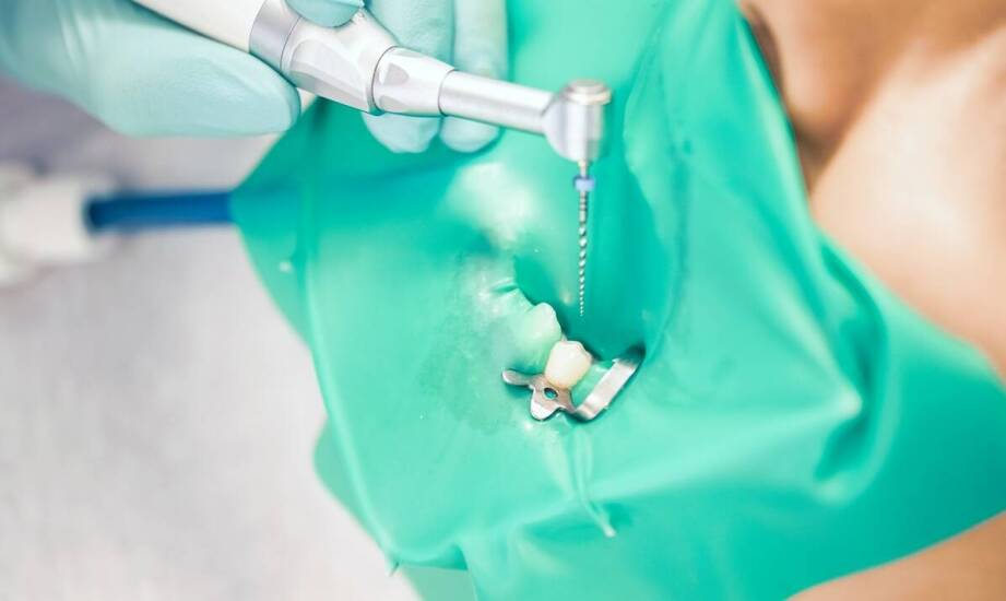 Kompozyt chemoutwardzalny: jak zapewnia szybkie i skuteczne wypełnienia?