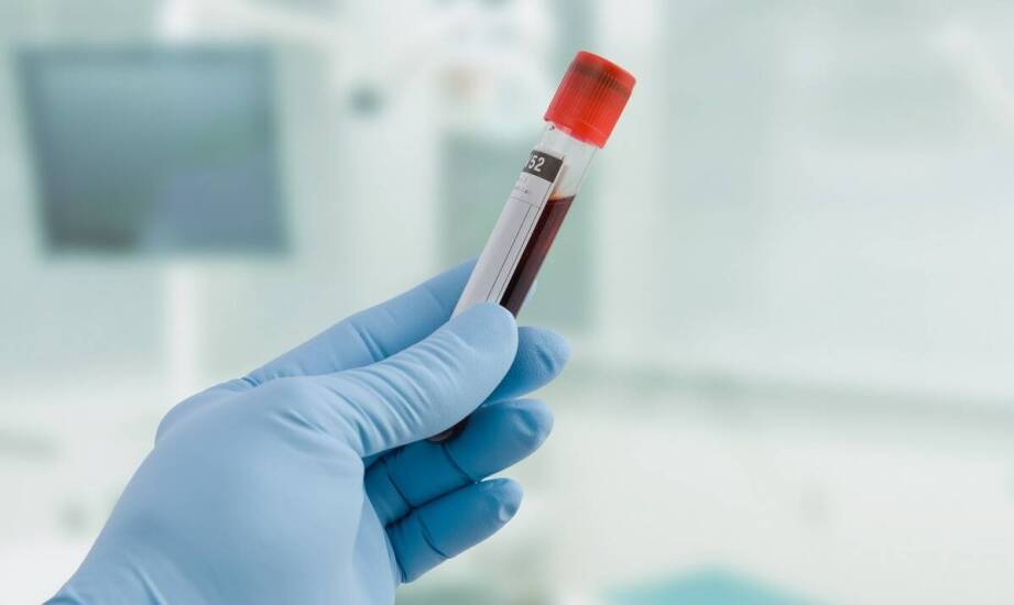 Krew w moczu. Dlaczego warto zgłosić ten fakt urologowi?