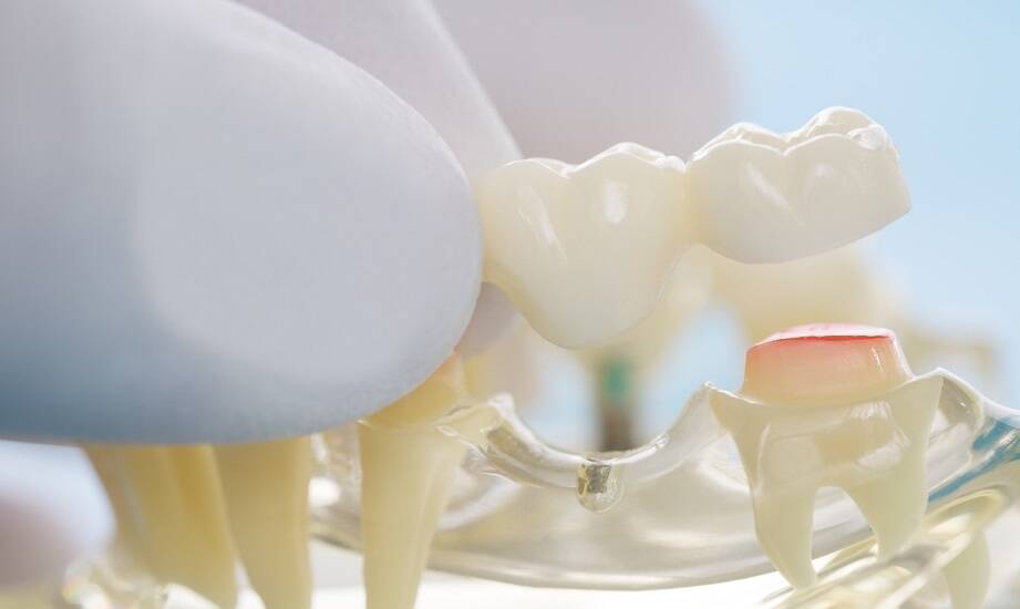 Protetyka stomatologiczna – jakie możliwości oferuje współczesna stomatologia?