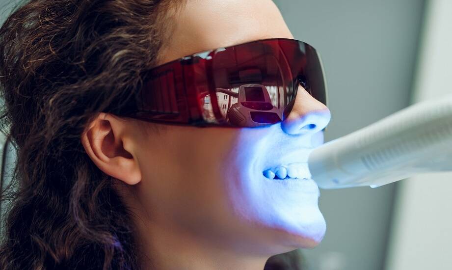 Jakie są zalety stosowania nowoczesnych lamp LED w wybielaniu zębów?