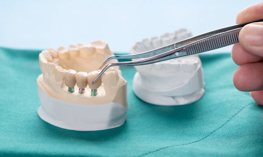 Nowoczesne materiały w protetyce: Co oferuje obecny rynek?