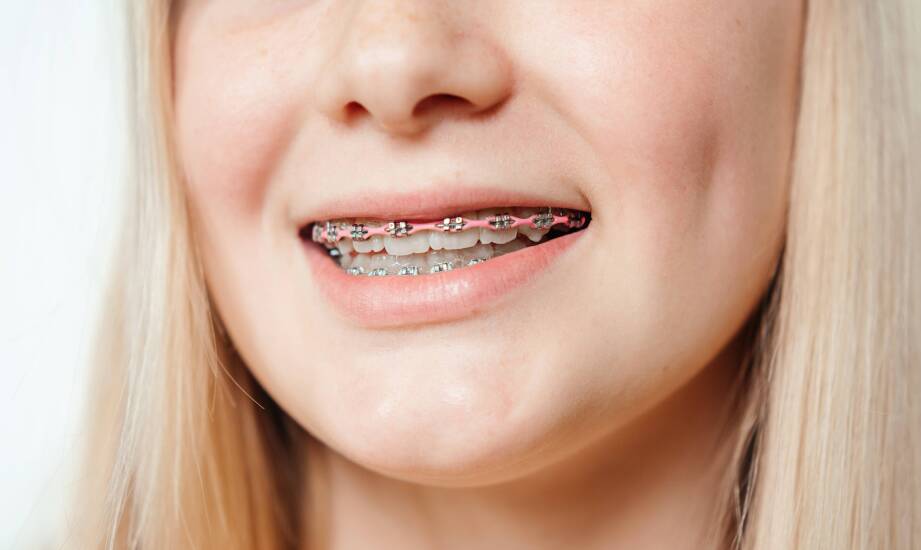 Jakie metody stosowane są w leczeniu ortodontycznym u dzieci?