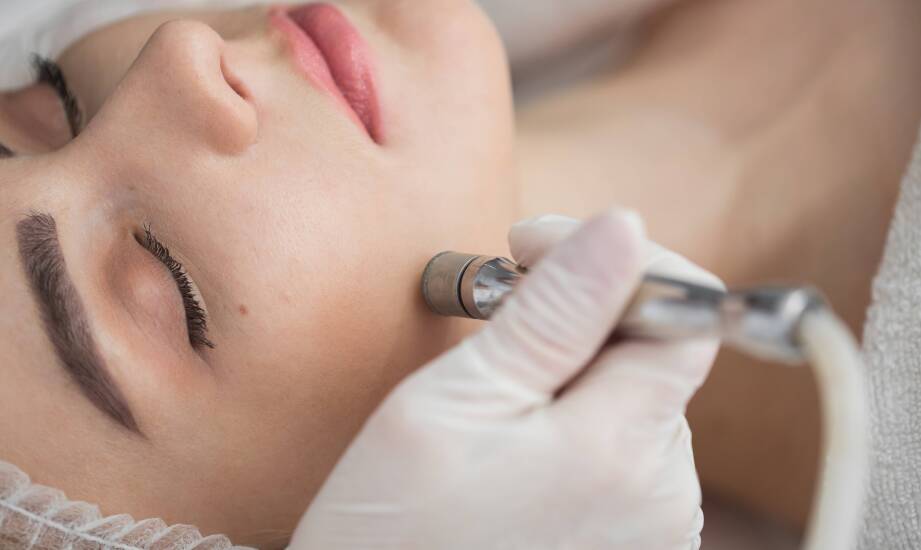 Efekty długoterminowe stosowania mikrodermabrazji korundowej