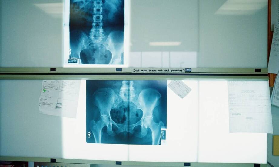 Wpływ zaawansowanych funkcji programów do zdjęć RTG na precyzję diagnostyki