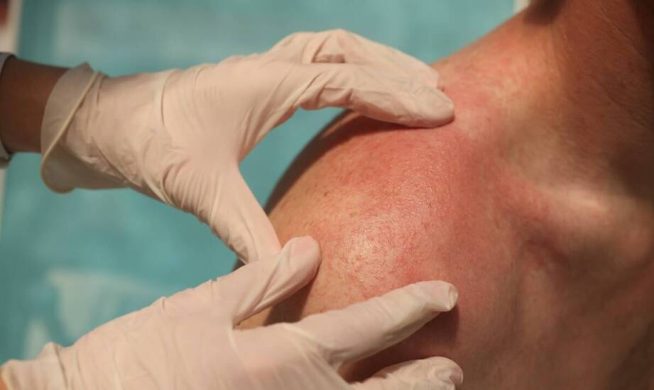 Co zostawia żądło: jak rozpoznać, że owad je pozostawił?