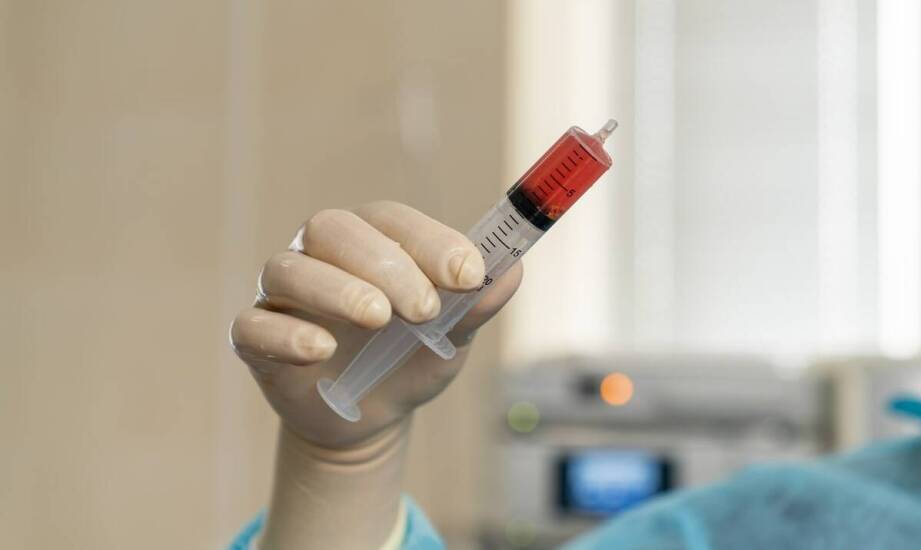 Kiedy warto rozważyć zabieg z osoczem bogatopłytkowym na trądzik?