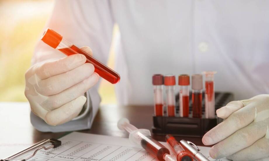 Czy można pić alkohol przed badaniami profilaktycznymi krwi?