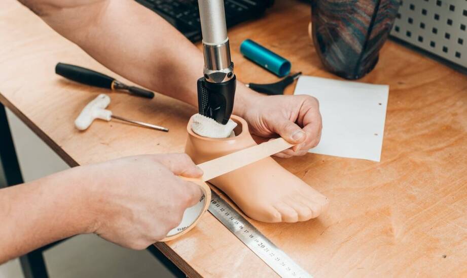 Zakładanie protezy podudzia – jakie są najczęstsze wyzwania i jak je pokonać?