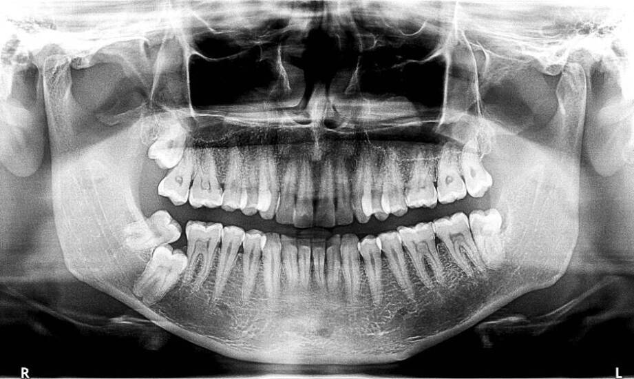 Rola diagnostyki CBCT w planowaniu leczenia stomatologicznego