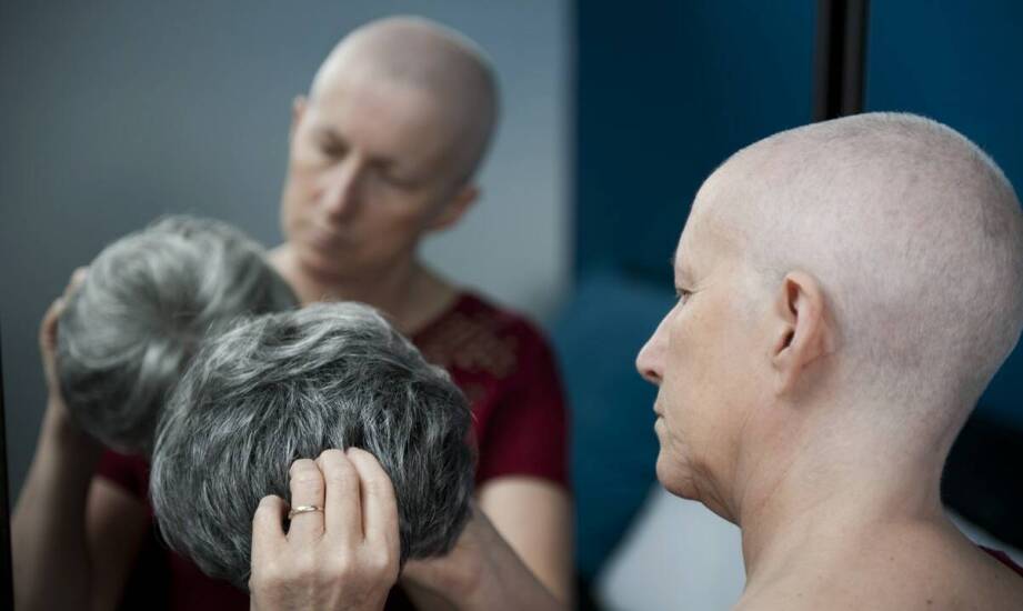 Kiedy warto skonsultować się z trychologiem na różnych etapach łysienia?