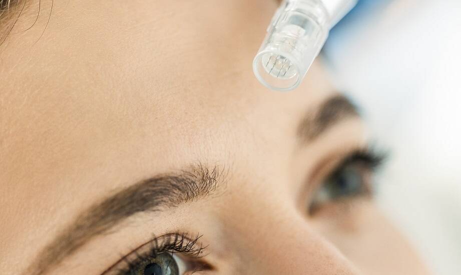 Rola Dermapenu w stymulacji produkcji kolagenu