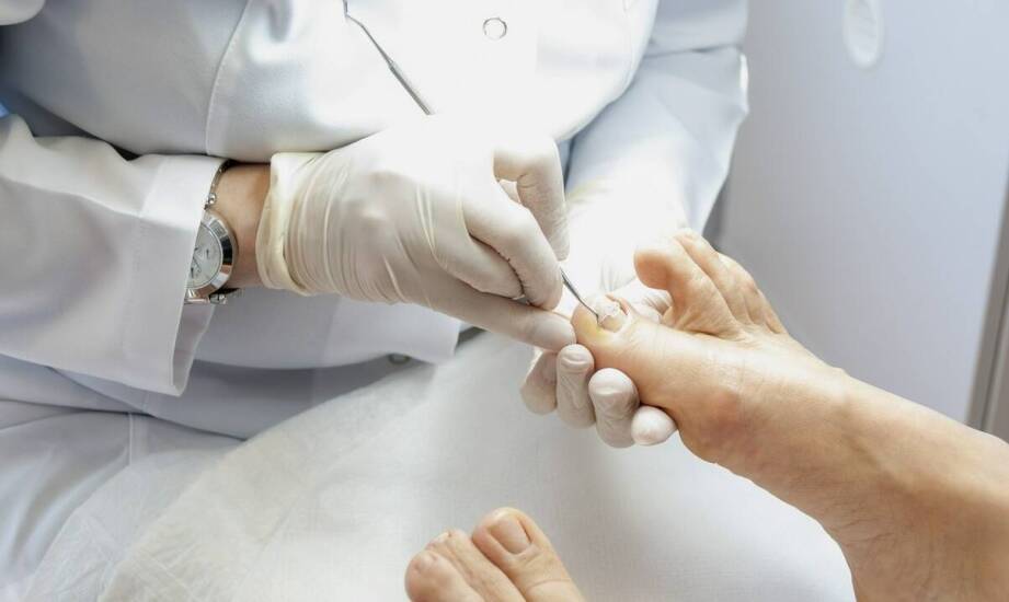 Proces korekty wrastających paznokci przy użyciu ortonoksyjnych klamer