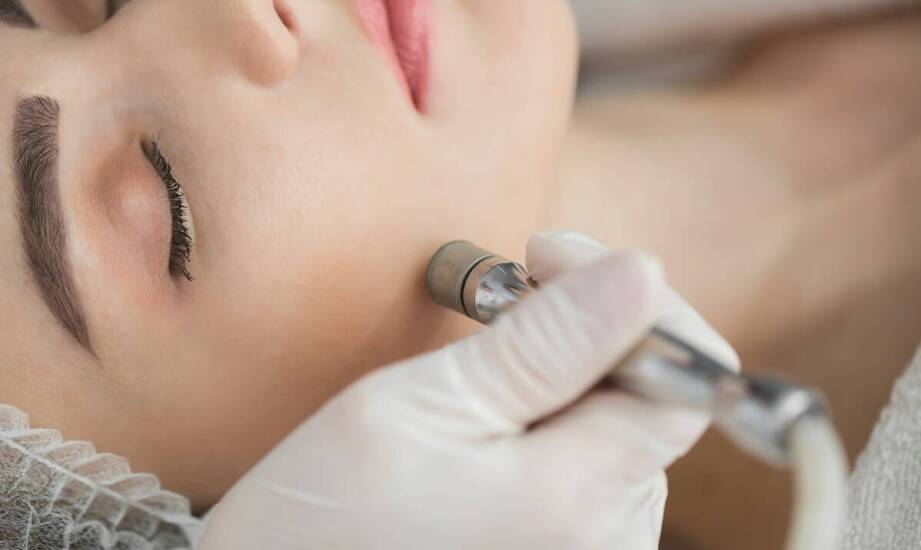 Mikrodermabrazja – jakie efekty można osiągnąć przy dojrzałej skórze?