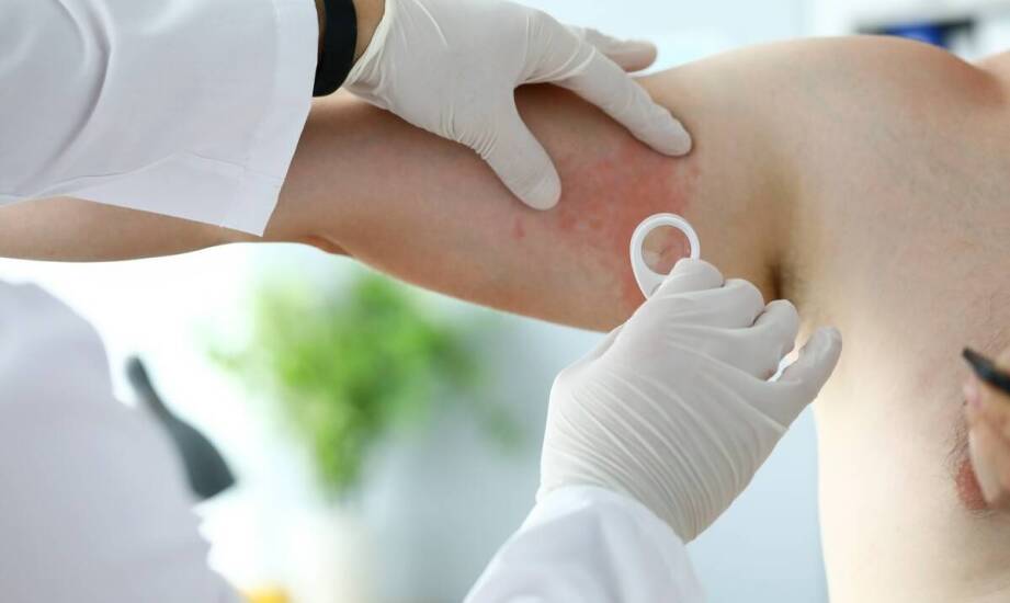 Świerzb a inne pasożytnicze choroby - co warto wiedzieć?