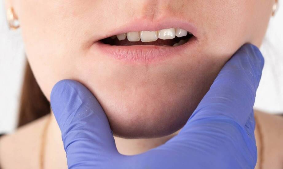 Jak oddychanie przez usta wpływa na rozwój wad zgryzu?