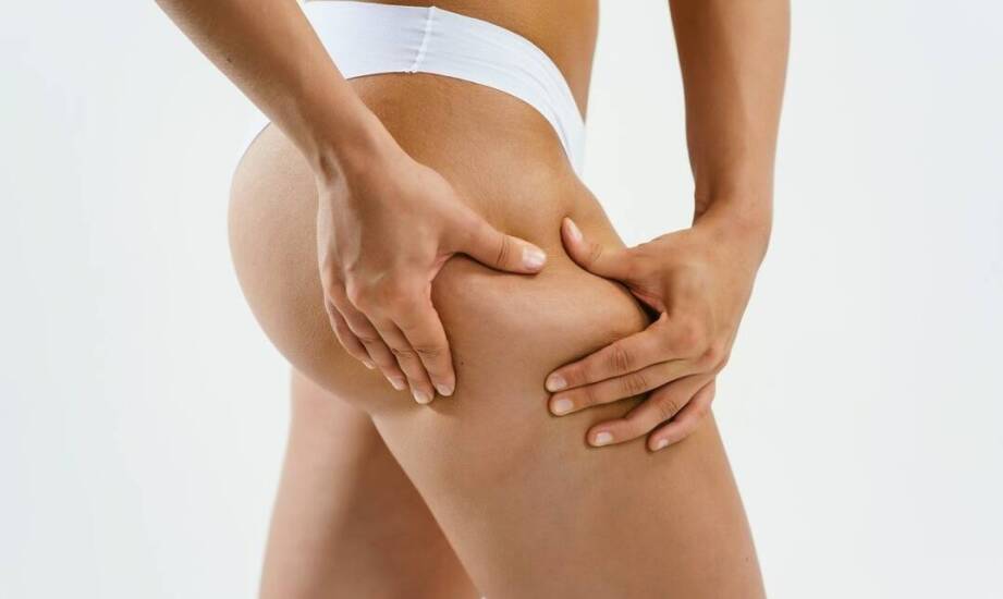 Jakie zabiegi na cellulit warto wykonać?