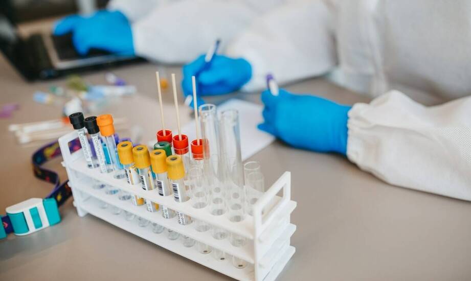 Jakie testy na SARS-CoV-2 oferuje diagnostyka w Żorach?