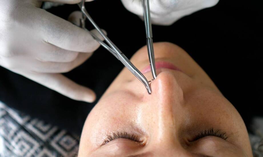 Jak wygląda proces gojenia po zabiegu korekcji nosa?