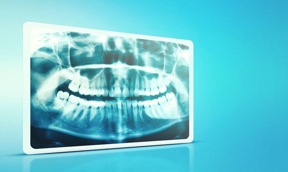 Jakie są różnice między tradycyjnym RTG a komputerową tomografią w stomatologii?