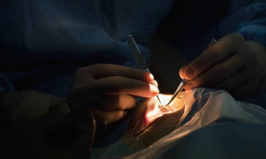 Jakie koszty pokrywa refundacja protezy oka, a co pacjent musi opłacić samodzielnie?