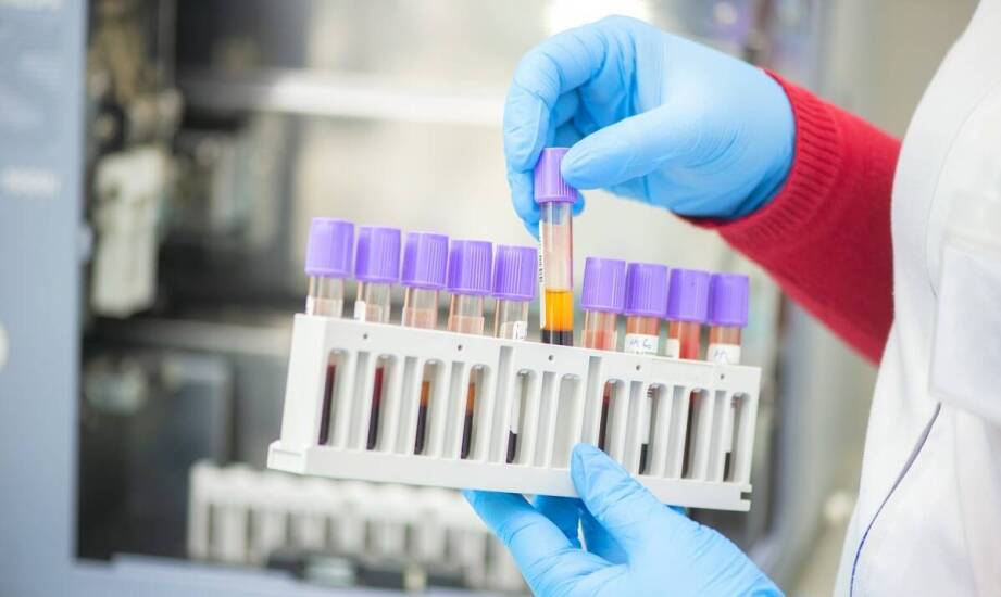 Jak diagnostyczne testy przyczyniają się do szybkiego wykrywania zakażeń CMV?