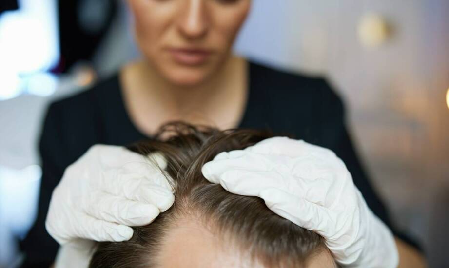 Jak wizyta u trychologa może pomóc w zwalczaniu różowego łupieżu Giberta?