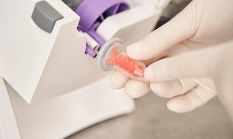 Wirówka do A-PRF w praktyce – najważniejsze aspekty użytkowania