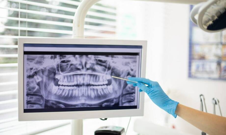 Jak zastosowanie wewnątrzustnych kamer wpływa na diagnostykę w stomatologii?