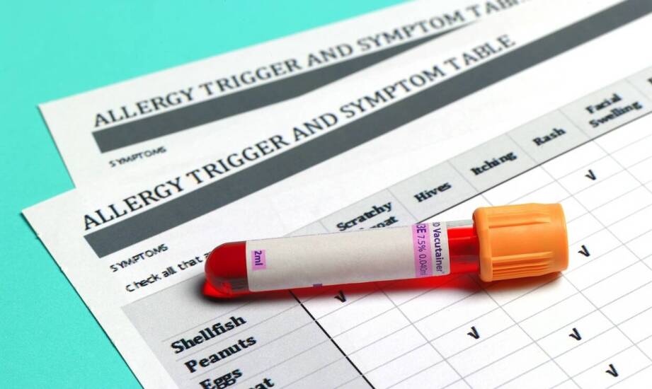 Testy alergiczne z wykorzystaniem biorezonansu: innowacyjne metody i korzyści
