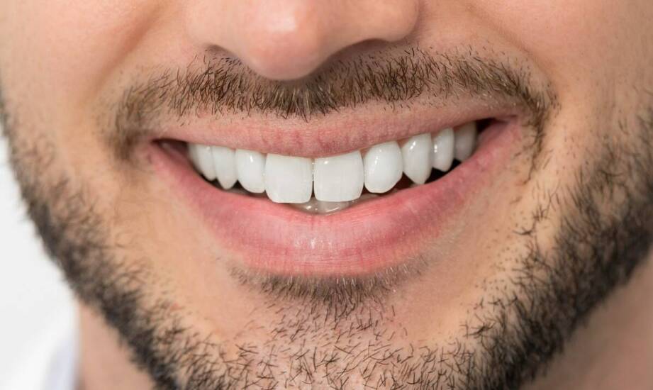 Proces adaptacji do nowych porcelanowych licówek: Czego się spodziewać?