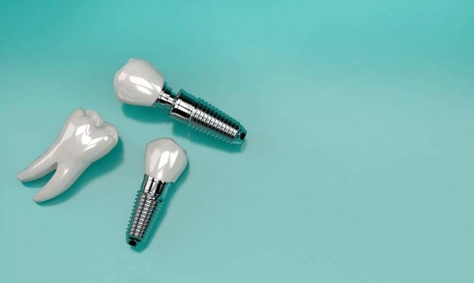 Diagnostyka przedimplantacyjna: klucz do sukcesu w implantologii