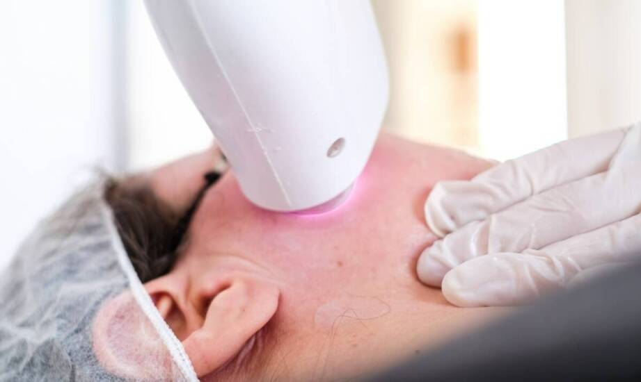 Terapia LED w leczeniu trychologicznych problemów