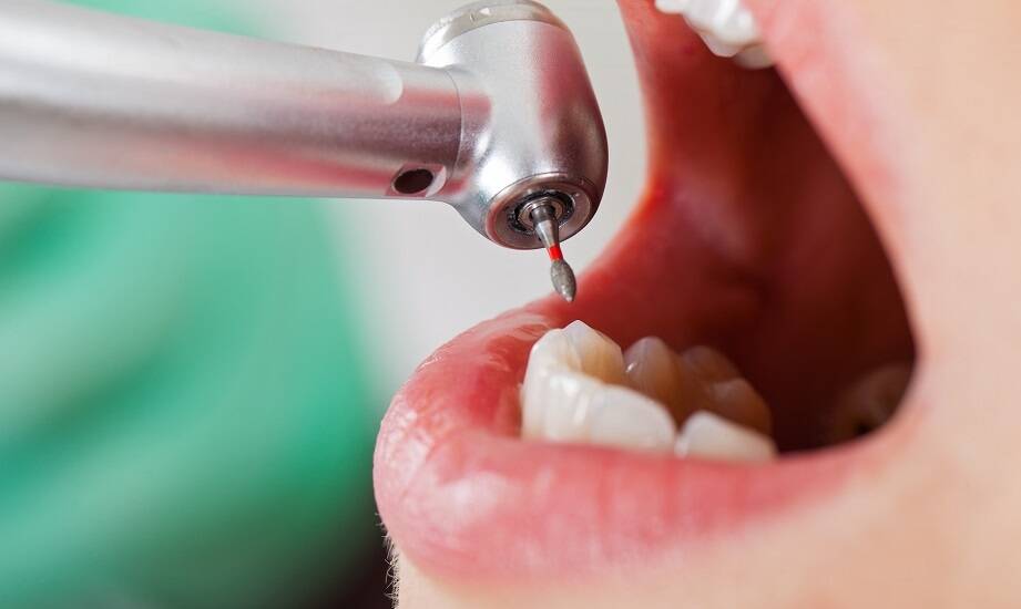Jak wygląda leczenie próchnicy?