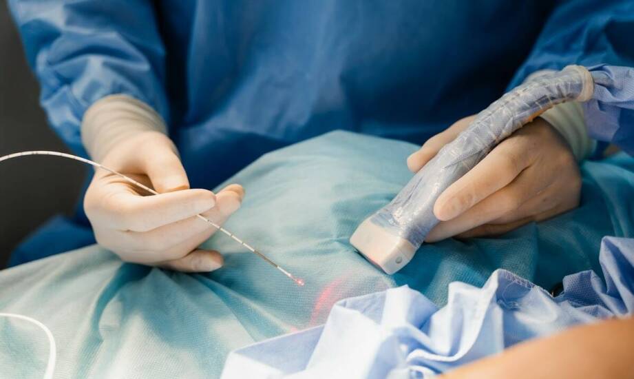 Porównanie metod usuwania keloidów: laser kontra chirurgia