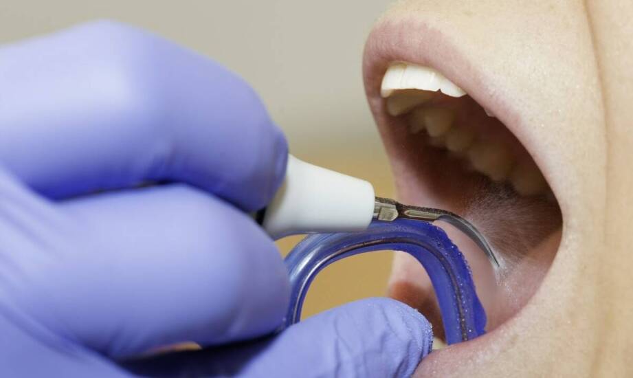 Kiedy fleczer uratuje ząb przed infekcją?