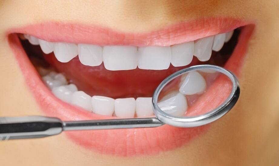 Jak wybielanie zębów może poprawić estetykę uśmiechu?